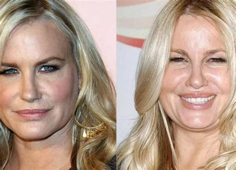 jennifer coolidge before surgery|Jennifer Coolidges plastic surgery and stunning transformation